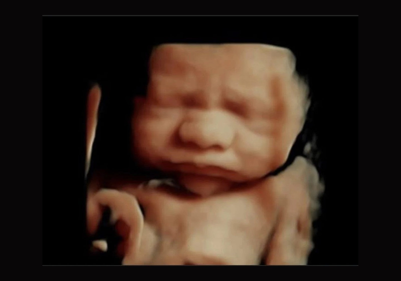 Scan to Baby keepsake bundle