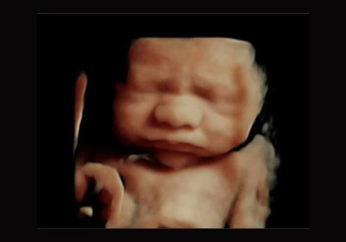 Scan to Baby keepsake bundle